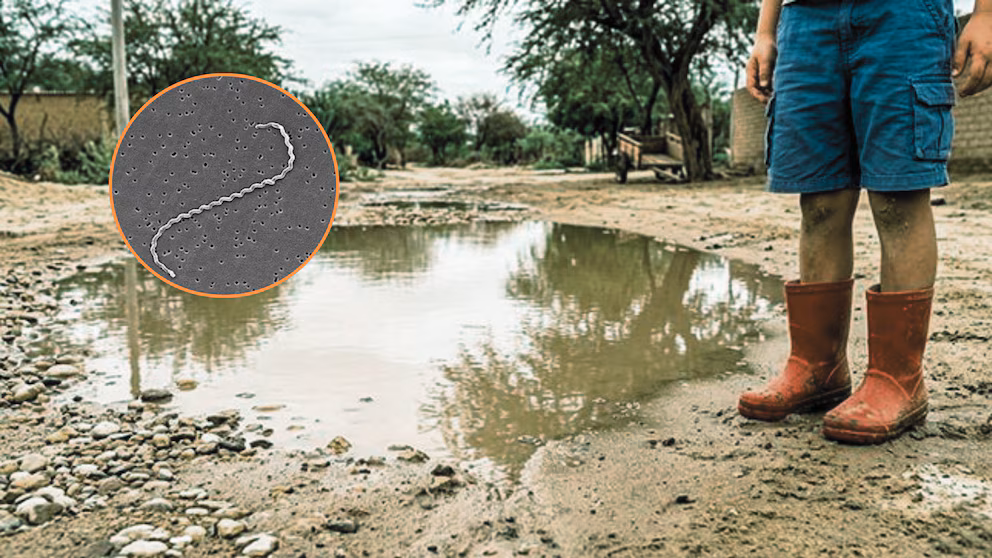 Perú registra nueve muertes por leptospirosis: estas son las regiones más afectadas y los síntomas de alerta, según especialista